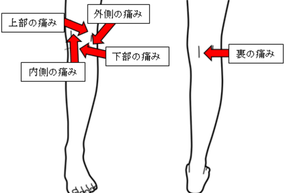 膝の痛み